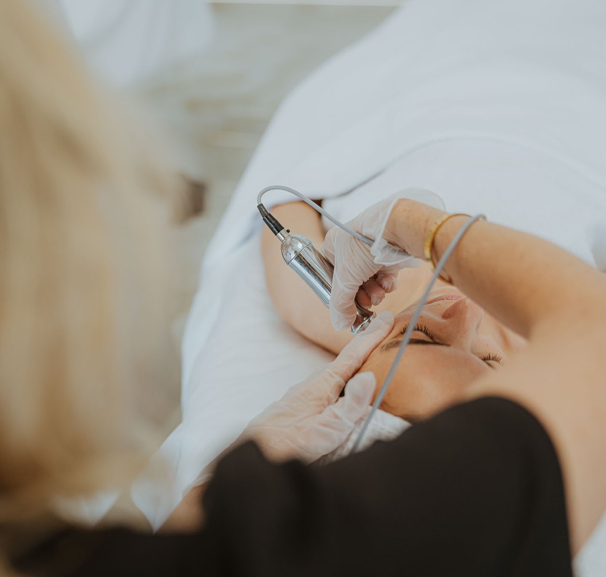 Mezoterapie BDR – aplikace mikrovpichů